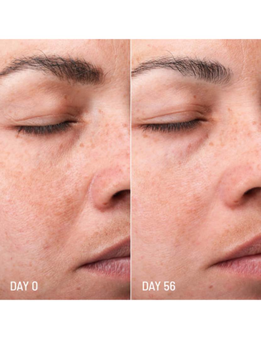Lotus Radiance Darkspot Treatment