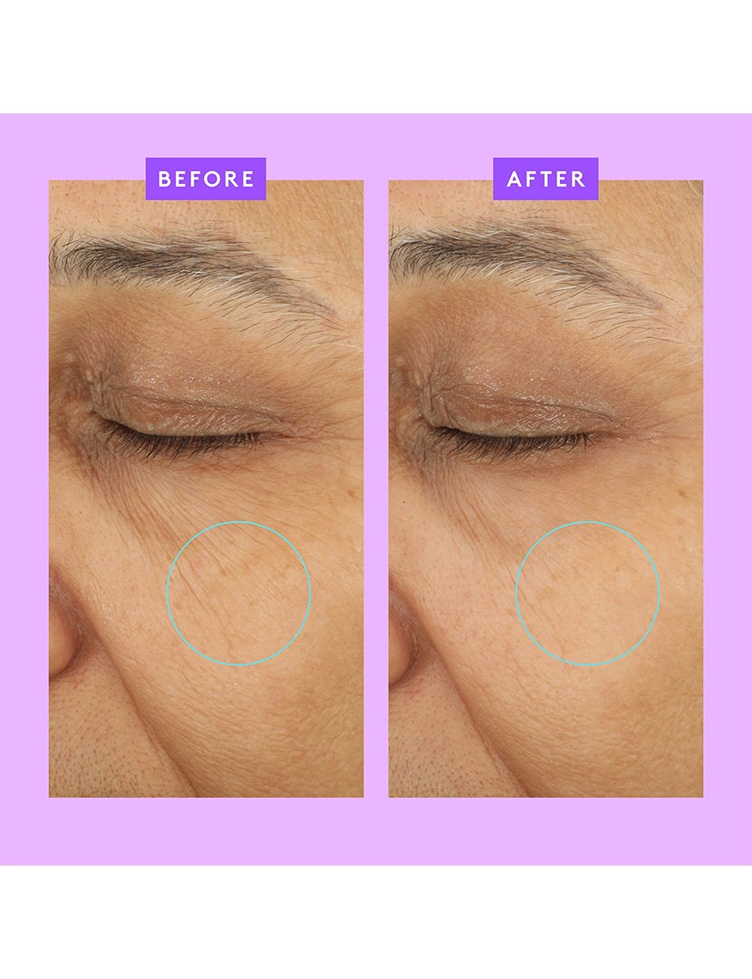 Ceramighty AF Eye Balm 15 ml